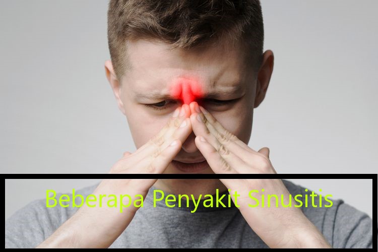 Beberapa Penyakit Sinusitis